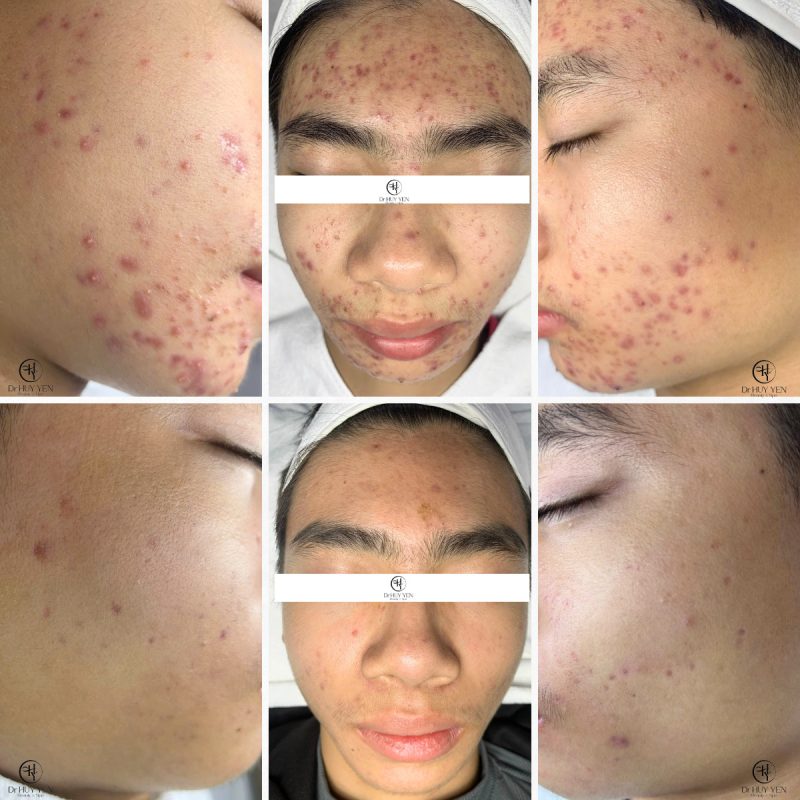 Dr Huy Yến Beauty And Spa